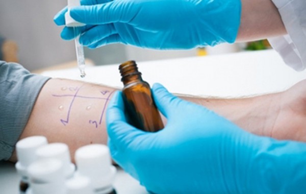 Allergologia
