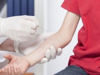 Test per allergie a farmaci