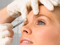 Filler e Fillers Peels