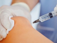 Sclerosanti per teleangectasie