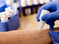 Test per allergia ad imenotteri