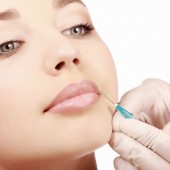 Più volume alle labbra con i filler